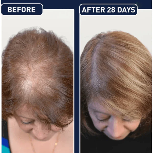 FEG plus hair growth spray (2)